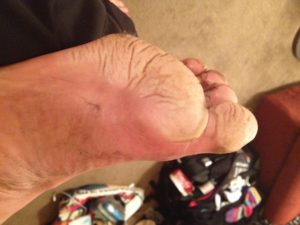 Post Race damage